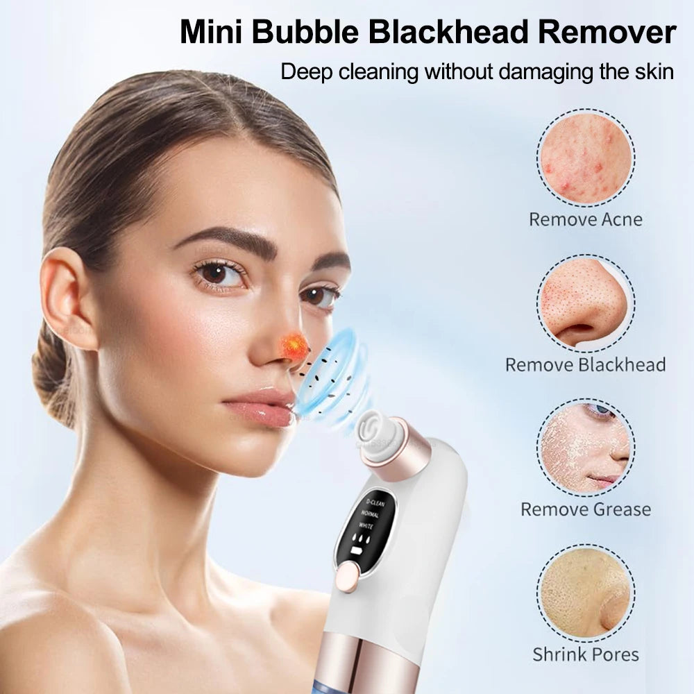 GlowPure - Blackhead Remover